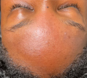 After